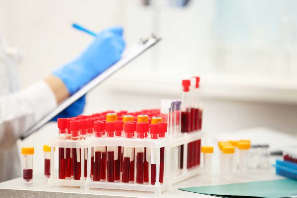 What Are The Benefits Of Online Blood Test Lab and How It Is Cost ...