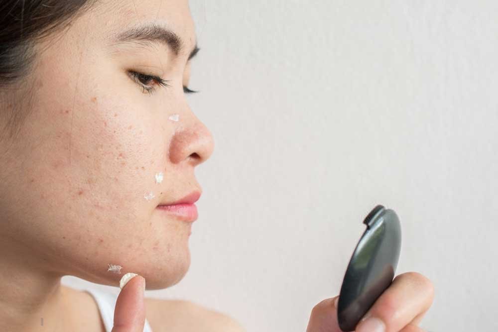 how to get rid of scars on your face at home